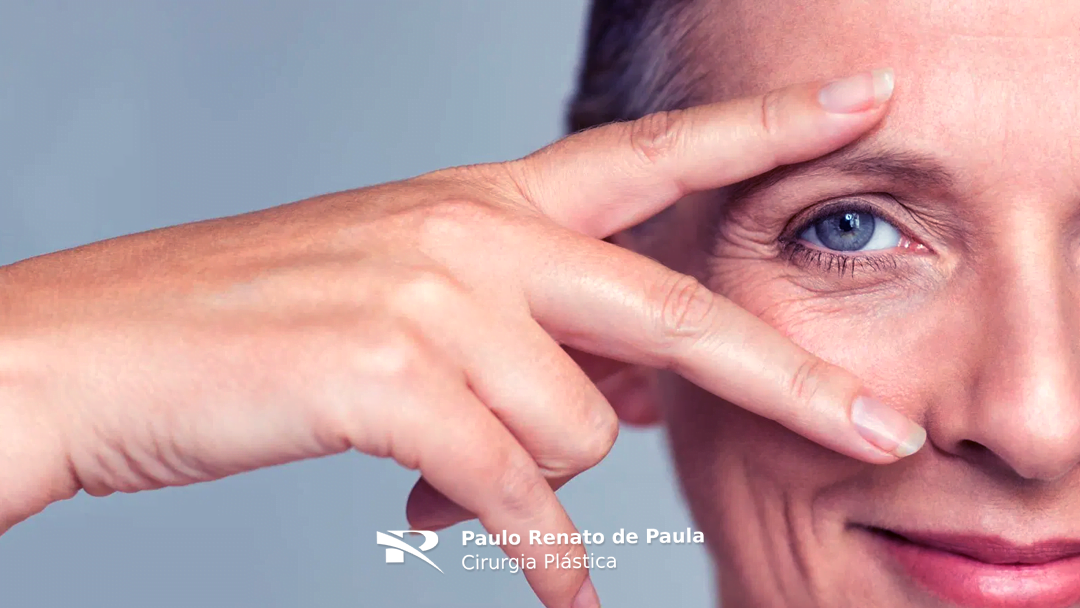 Cirurgia das Pálpebras – Rejuvenescendo o rosto através do Olhar