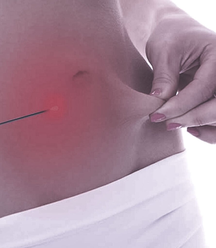 Cirurgia Plastica Lipolaserl Goiania Dr Paulo Renato