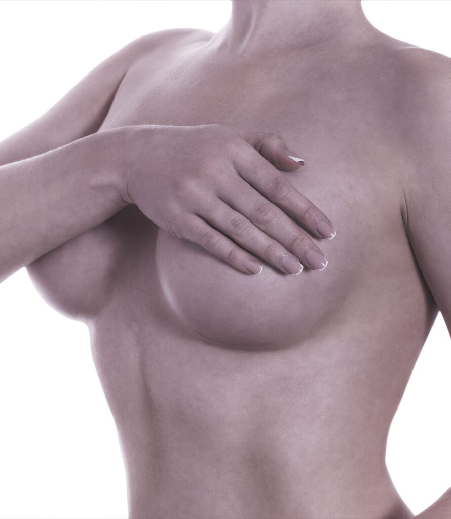 Cirurgia Plastica Mamoplastia Redutora Goiania Dr Paulo Renato
